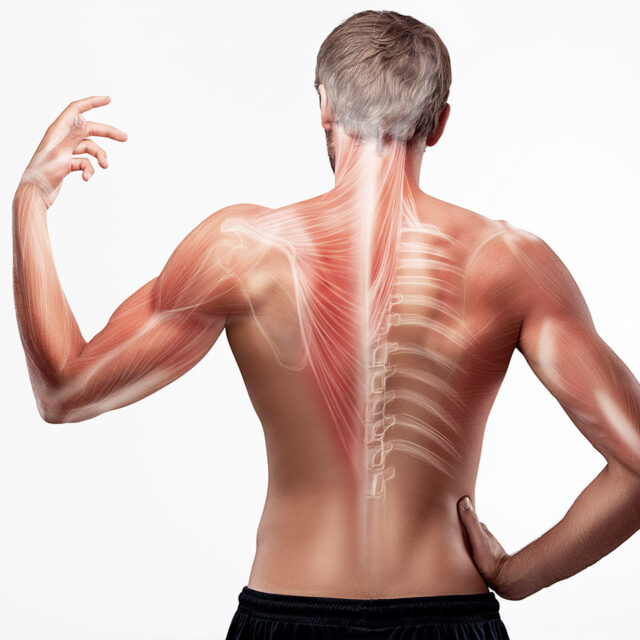 Primo Centri Medici Osteopatia Muscoli Schiena